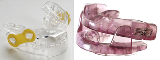 Oral Appliance Therapy