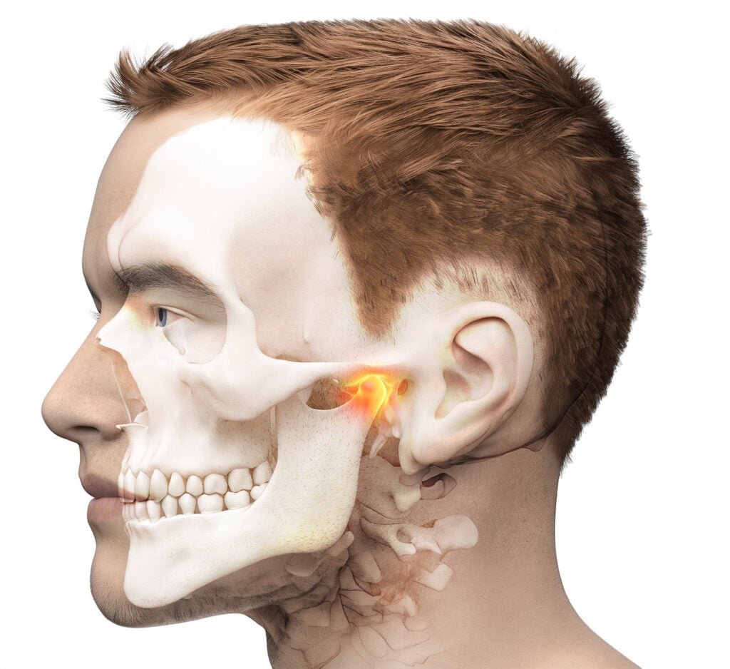 Medical illustration showing a side view of a man's head with the skull partially visible, highlighting the temporomandibular joint (TMJ) near the ear in orange.