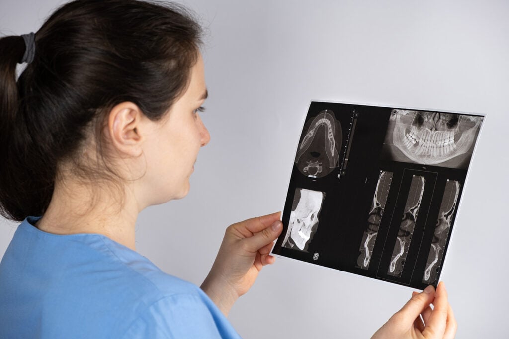 A woman in scrubs holds and examines a dental X-ray sheet showing multiple views of teeth and jaw.