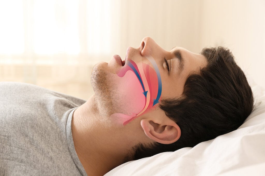 A man lies on his back in bed with a diagram showing airflow through his nose and throat, illustrating breathing during sleep.