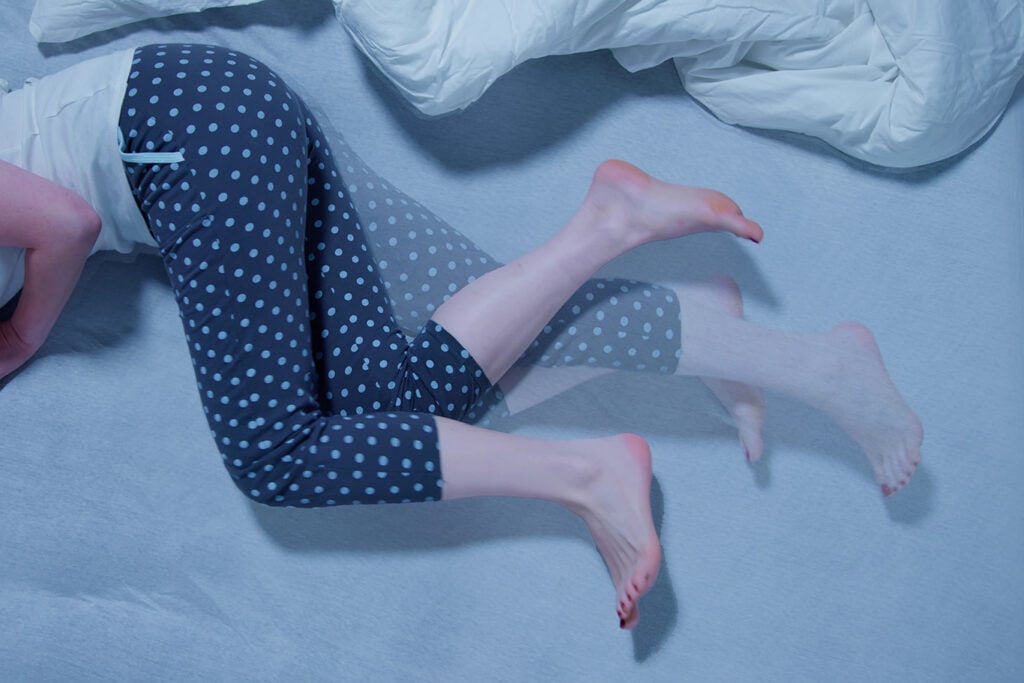 Person in polka dot leggings lying on a bed with a ghostly overlay showing leg movement, next to a white blanket. restless legs syndrome